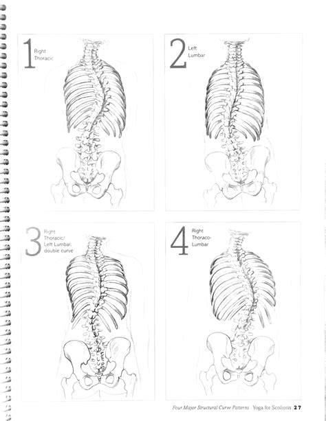 Scoliosis Curve Types