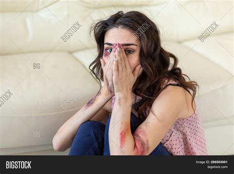 Victim Abuse Domestic Image And Photo Free Trial Bigstock