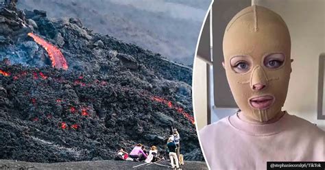 Woman Who Survived A Volcano Eruption Recalls The Horrific Day That