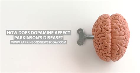 Parkinson's disease is an aggressive and progressive neurodegenerative disorder that depletes dopamine (da) in the central nervous system. How Does Dopamine Affect Parkinson's Disease? - Parkinson ...
