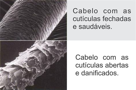 Estrutura Do Fio De Cabelo