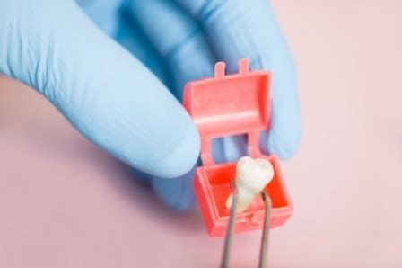 Doing so can motive the clot to end up dislodged. Tooth Extraction | Viet Giao Dental Clinic