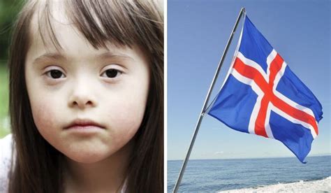 Iceland Called Out At Un For Aborting Almost 100 Of Babies Diagnosed