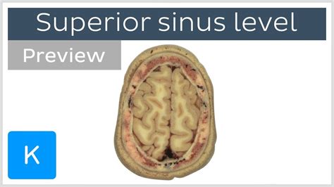 Cross Sections At The Superior Sagittal Sinus Level Preview Human