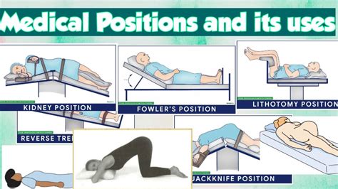 Patient Positioning Cheat Sheet Complete Guide For 2023 Atelier Yuwa