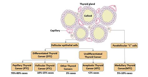 Thyroid Cancer Classification