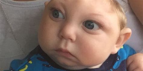 Baby Born Missing Most Of Brain Proves Doctors Wrong