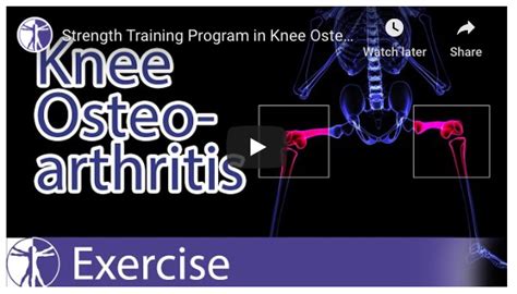 Strength Training Program In Knee Osteoarthritis Rehabilitation Zero