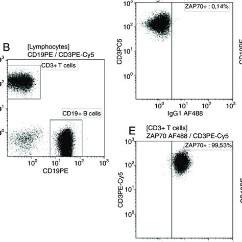 Detection Of Zap 70 Expression In Healthy Donors And Chronic Lymphocyte