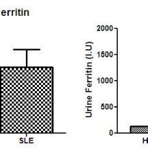 Serum And Urine Ferritin Levels Are Increased In Patients With Lupus