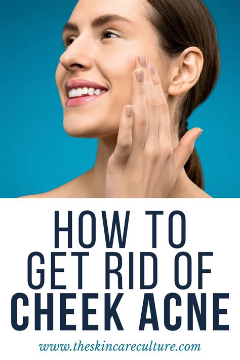 How To Get Rid Of Cheek Acne An Esthetician Explains Cheek Acne Cause Cheek Acne Acne Causes