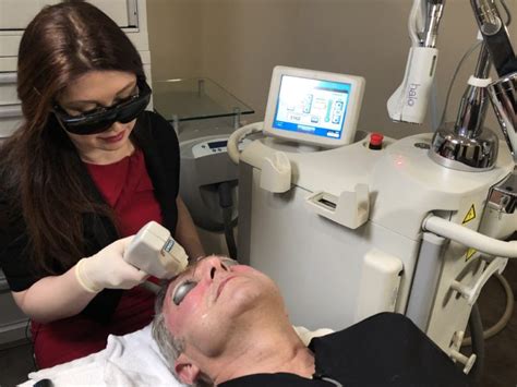 Bbl Photofacial Denver Co Highlands Ranch Bbl Photofacial