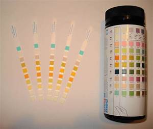 Siemens Urine Test Strips Results Chart