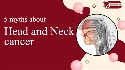 5 Myths About Head And Neck Cancer Dr Prabhat Chandra Thakur