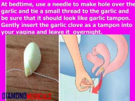 See What Happens If You Insert A Garlic Clove Inside Vagina Youtube