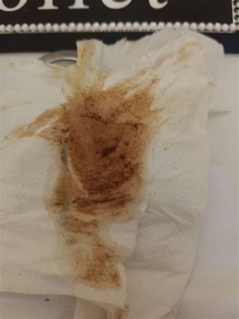 Dark Brown Discharge During Ovulation Sharedoc