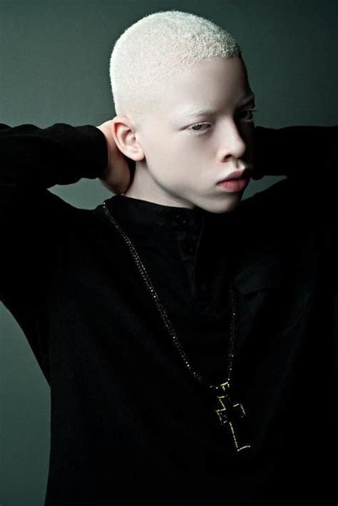 Modelo Albino Foto Portrait Portrait Photography Pretty People Beautiful People Melanism