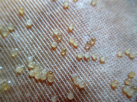 You are now reading the article newborn baby. Kujaku Koi Eggs With Black Eyes | Marugen Koi Farm