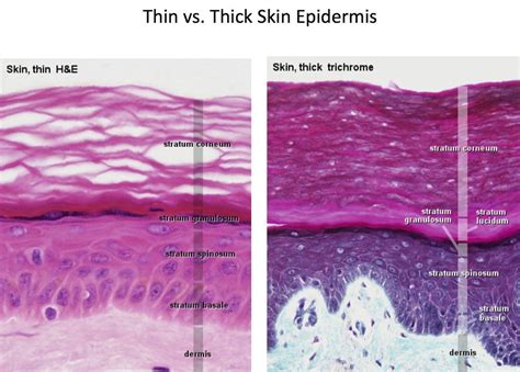 Thin And Easily Bruised Skin Causes And Self Help Ideas Youmemindbody