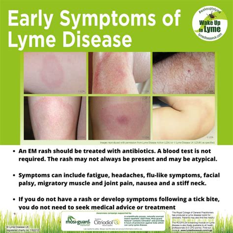 Identifying Lyme Disease Rash