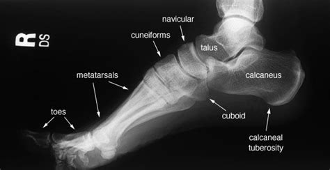 There is a printable worksheet available for download here so you can take. Foot -- Lateral View, Labelled | Radiology student ...