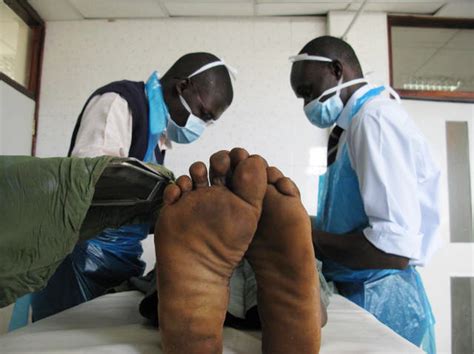 An Aids Ravaged Nation Turns To Circumcision Wbur