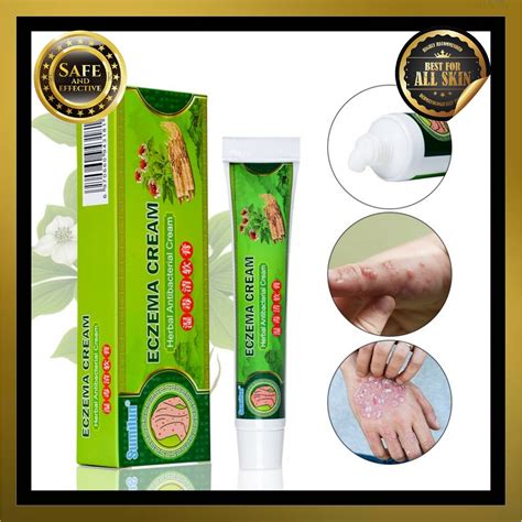 Buy Psoriasis Cream Eczema Ointment Scalp Psoriasis Hand Tinea Foot