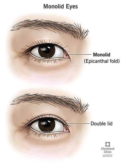Monolid Eyes Epicanthal Folds And Causes