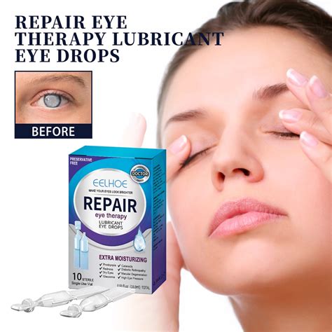 Eye Drops Eye Drop Improve Eyesight Protection Relieve Eyes Fatigue Dry Itchy Redness Blurred
