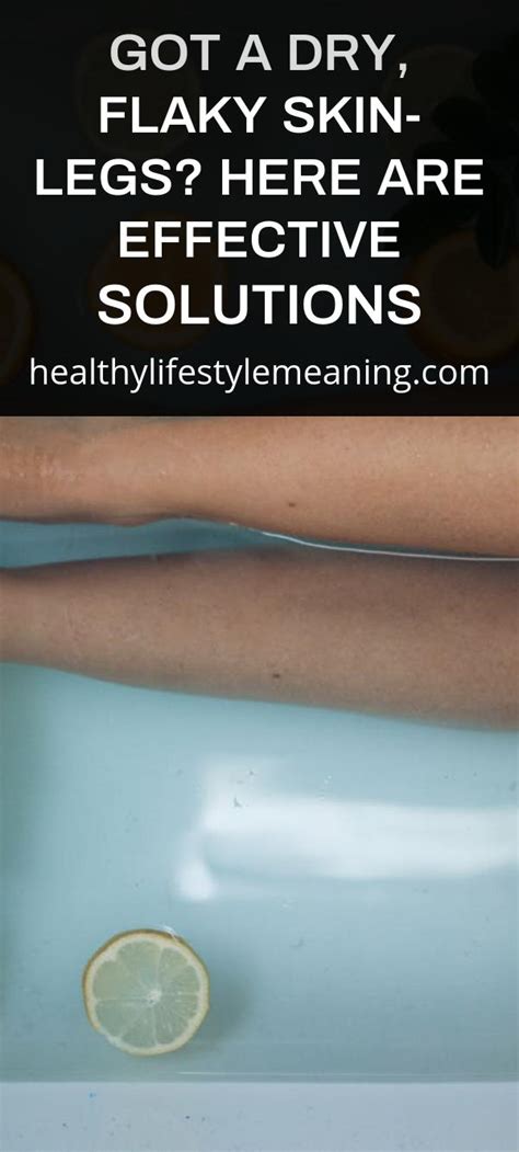 Got A Dry Flaky Skin Legs Here Are Effective Solutions Healthy