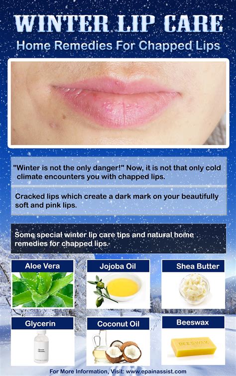 Winter Lip Care Natural Home Remedies For Chapped Lips