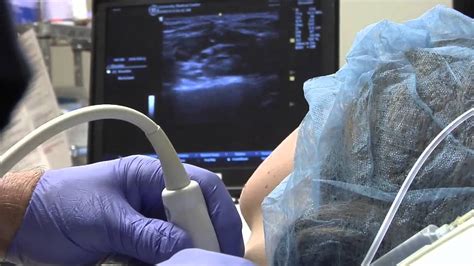 Ultrasound Guided Ulnar Nerve Block On Vimeo Images And Photos Finder