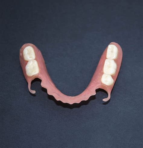 Гибкие Протезы Зубов Отзывы Цена Фото Telegraph