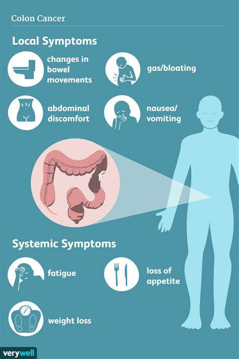 Nausea and vomiting, which may. Colon Cancer: Signs, Symptoms, and Complications