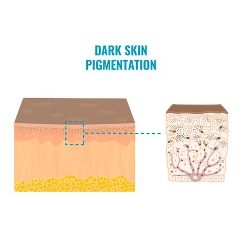 Melanosome Cells Skin Pigmentation Mechanism Melanin Pigment Content