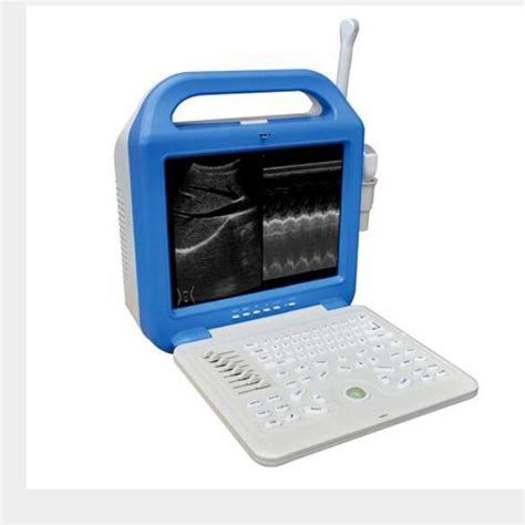 Ultrasound Scanner With Convex Linear Trans Vaginal Trans Rectal Probe