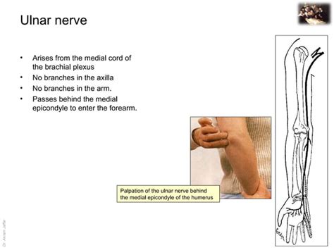 Applied Anatomy Ulnar Nerve Injury