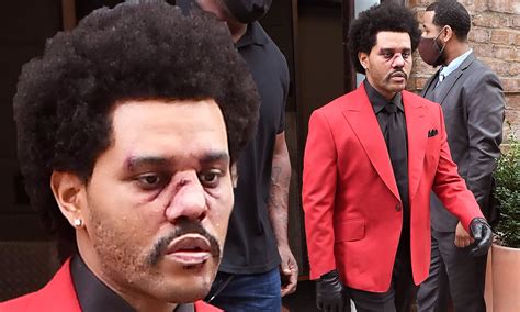 Поделиться the weeknd and ariana grande — save your tears (remix) (2021). The Weekend Wears Bandages On AMA!!! - Hip Hop News Uncensored
