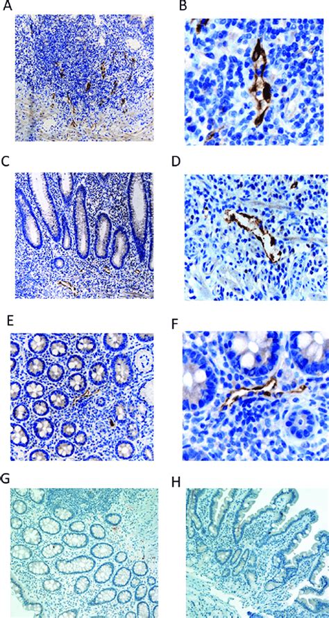 Immunohistology Of Venule Endothelial Expression Of Ccl21 In Intestinal