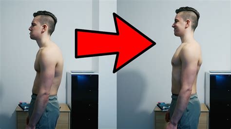 Forward head posture when the head is extending forward past the shoulders, caused by tilting our heads forward to look at our phones and computers. How To Fix Your Posture At Home (IN 4 MOVES!) - YouTube