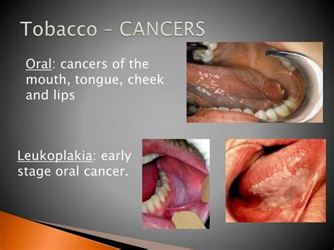 Ppt Tobacco Overview Powerpoint Presentation Free Download Id2125389