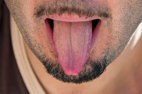 Male Oral Thrush Xxx Porn Library