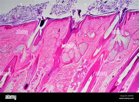 Sebaceous Glands In Human Skin With Hair Follicles X25 At 10 Cm Wide