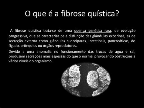 Cystic fibrosis (cf) is a genetic disorder that affects mostly the lungs, but also the pancreas, liver, kidneys, and intestine. Mutações génicas - fibrose quística