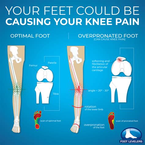 Your Feet Could Be Causing Your Knee Pain Thomaston Chiropractic Clinic