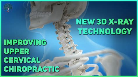 Improving Upper Cervical Chiropractic With 3d Imaging Youtube