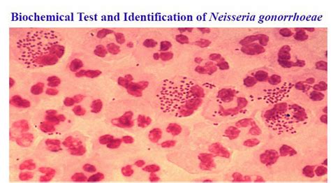 Infection may involve the genitals, mouth, or rectum. Biochemical Test and Identification of Neisseria gonorrhoeae