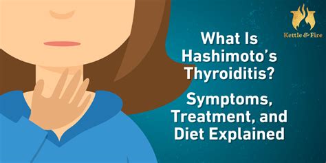 What Is Hashimotos Thyroiditis Symptoms Treatment And Diet Explained