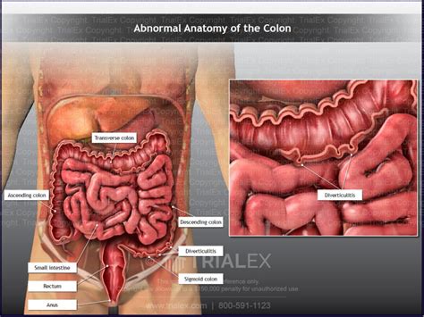 Abnormal Anatomy Of The Colon Trial Exhibits Inc