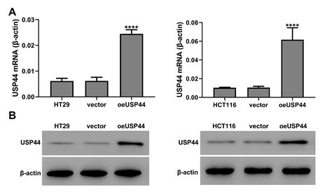 Usp44 Suppresses Proliferation And Enhances Apoptosis In Colorectal